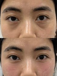 -Yestar重庆艺星医疗美容医院