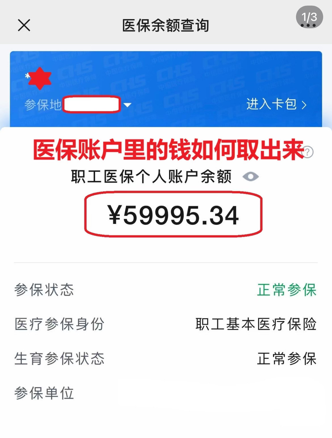 桐乡医保卡有有效期没的最新政策(2025年桐乡医保卡上的有效期限到了怎么办分享)