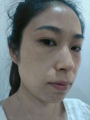 android_upload_pic-哈尔滨瑞丽医疗美容医院