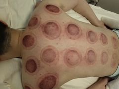 -常仁健康·经络推拿·按摩艾灸养生馆(长宁路店)