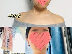 -中国人民解放军总医院第三医学中心