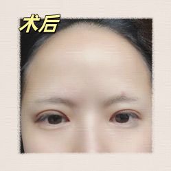 -素美医疗美容·西南眼鼻整形·修复基地
