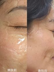 -青岛诺德医学美容医院