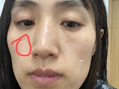 -大连市皮肤病医院