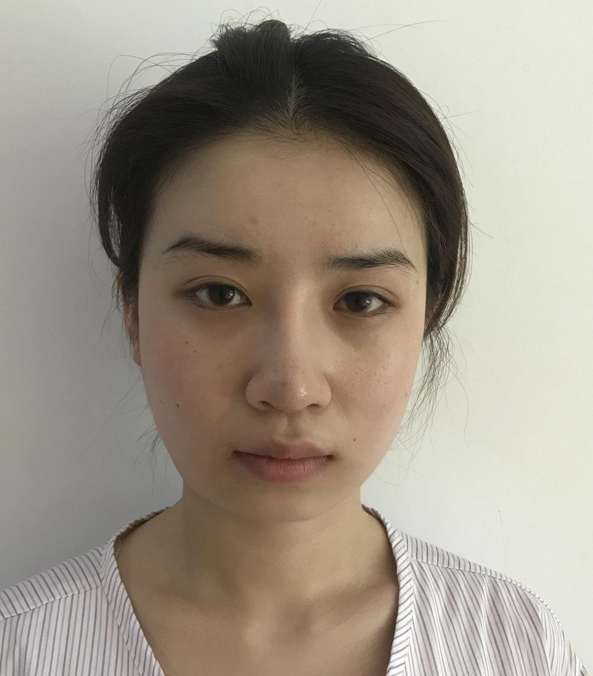 体验46天后效果分享