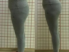 -修申骨雕小颜脊柱骨盆管理产后修复