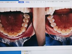 -方津口腔(旺墩路店)