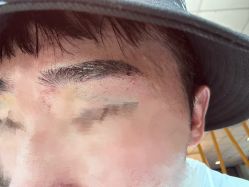 点击看大图 -熙朵美学植发·连锁品牌