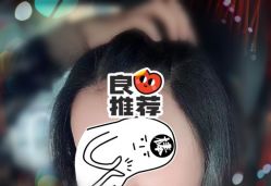 -大麦微针植发全国连锁