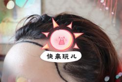 -大麦微针植发全国连锁