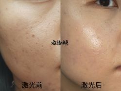 -青岛诺德医学美容医院