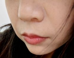 -广州健丽·去眼袋医疗美容机构