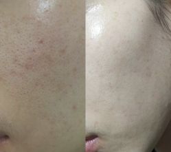 -Cream88颜皮肤管理中心