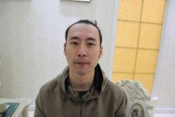 -大麦微针植发丨全国连锁