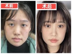 -素美医疗美容·西南眼鼻整形·修复基地
