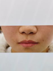 -Yestar 嘉兴艺星医疗美容医院