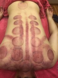 -兰派国际美容养生SPA