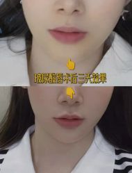 -上海漾颜医疗美容