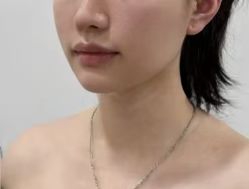 -Yestar重庆艺星医疗美容医院