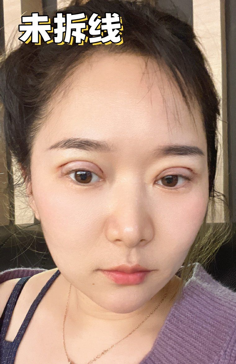 想成熟点,有韵味,我很推荐平扇形双眼皮