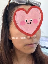体验后-SKINIST丽铂医疗美容