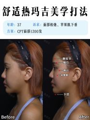 -深圳艺星医疗美容医院