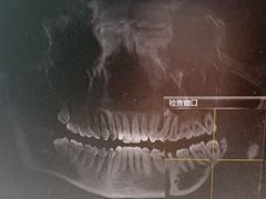 -杨浦区牙防所(中原门诊部)