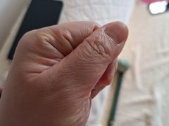 -Andrew指甲专科灰指甲·甲沟炎矫正·3D步态矫形鞋垫定制(上海法华镇路旗舰店)