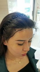 -大麦微针植发丨全国连锁