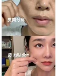 -美愈美肤MEIYU SKIN