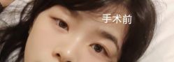 -广州美莱医疗美容医院