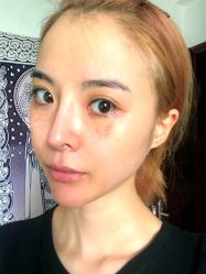 -深圳春天阳光医院·轮廓抗衰中心