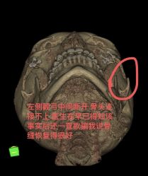体验后-上海华美医疗美容医院