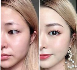 -上海漾颜医疗美容
