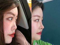 -东剑医学美容·注射美学中心