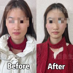 -颜和骨正·明哲式骨相美学整骨
