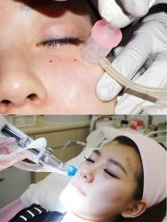 -北京米扬丽格医疗美容·联合丽格鼻整形中心