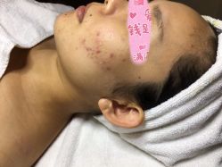 -皇族养心堂·净痘·修敏·御颜