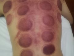 -赵氏盲人按摩(武林门店)