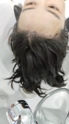 -大麦微针植发全国连锁