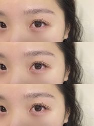 点击看大图 -美愈美肤MEIYU SKIN