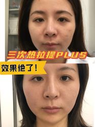 -Yestar宁波艺星整形医院