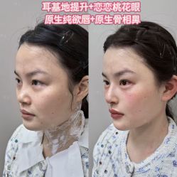 -深圳艺星医疗美容医院