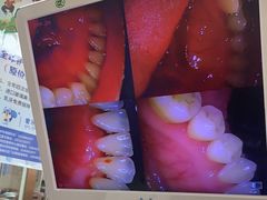 -爱牙联合口腔(门诊报销 海云庵店)