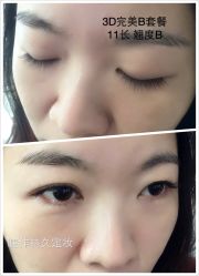 睫毛嫁接-光SPA科技美肤