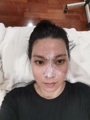 体验前-北京英煌医疗美容