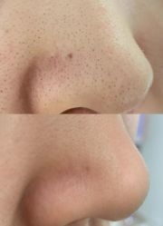 -美愈美肤MEIYU SKIN