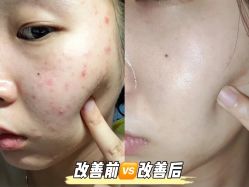 -Cream88颜皮肤管理中心