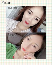 -Yestar艺星医疗美容医院
