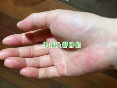 -上海交通大学医学院附属瑞金医院(总院)